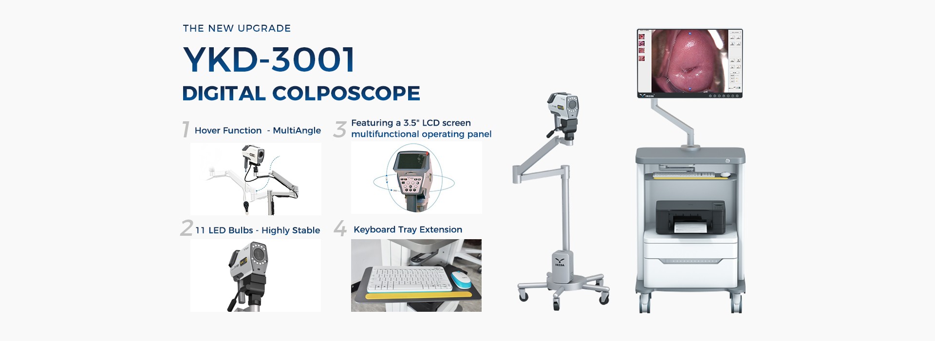 Digital Video Colposcope