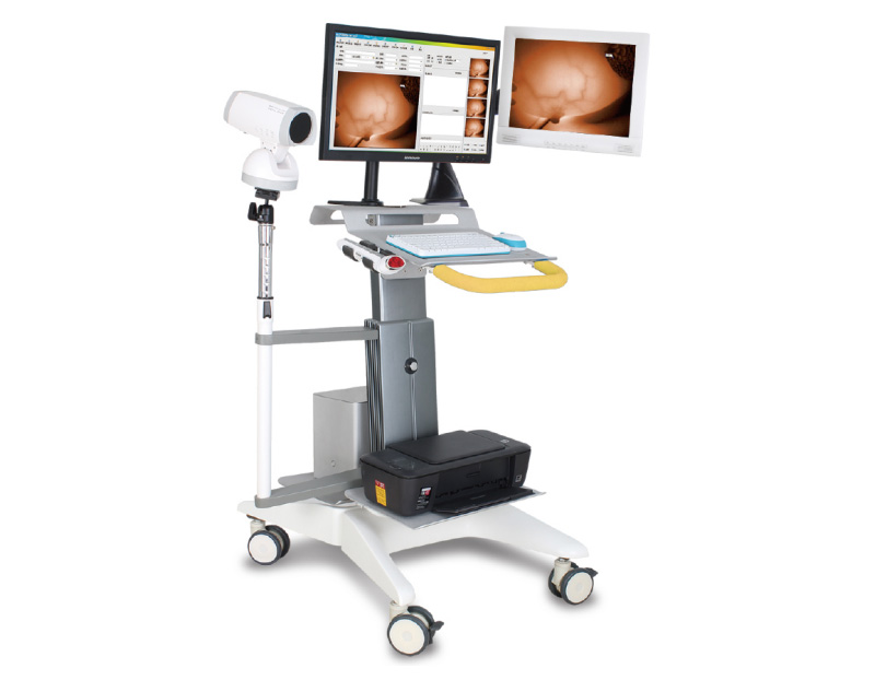 Medical HD Endoscopic Camera