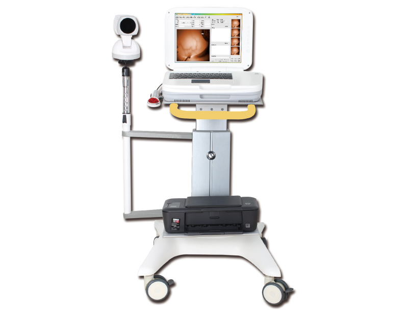 Infrared Mammary Gland Examination System