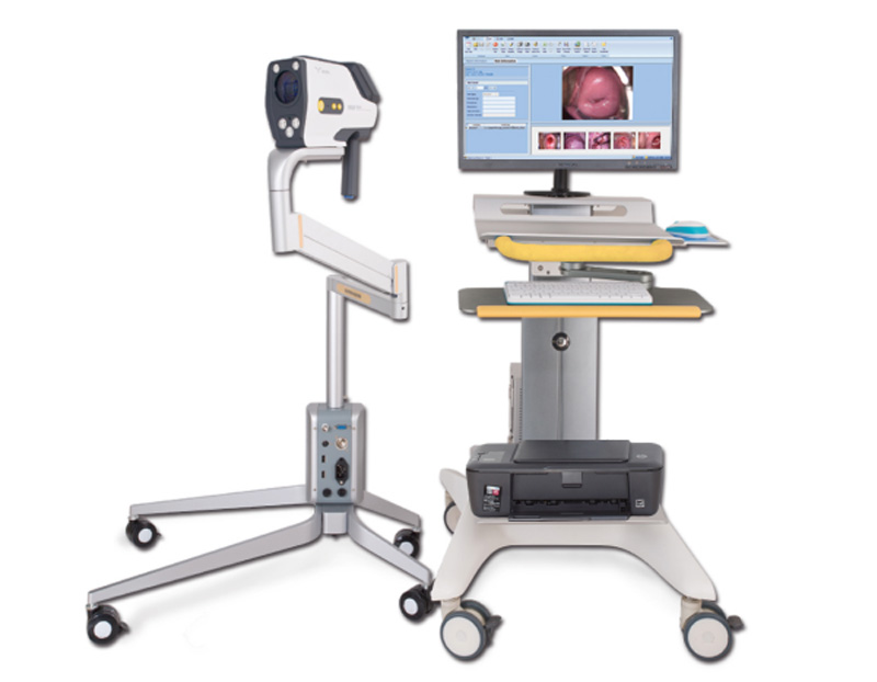 Digital Colposcope