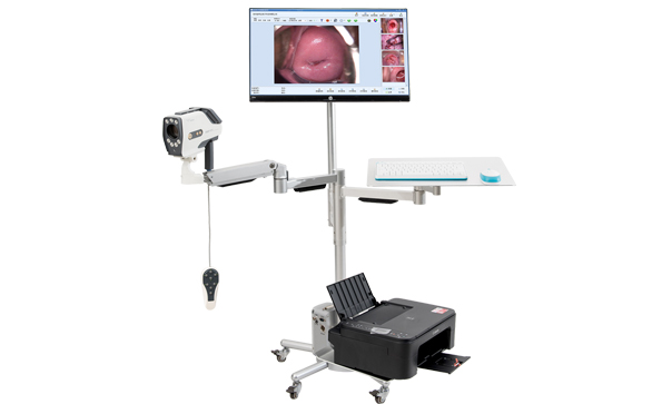 Medical Video Colposcope