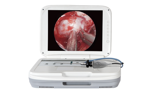 Endoscope Camera System