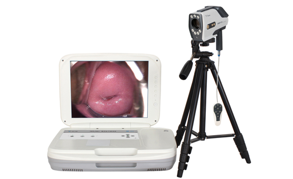 digital electronic colposcope