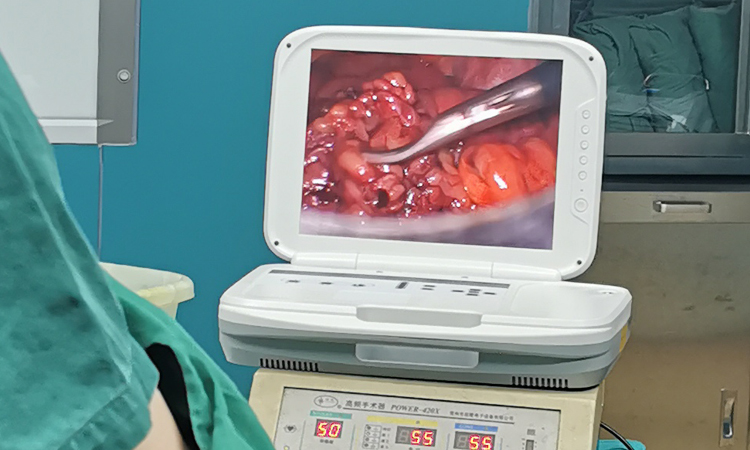 Laparoscopic hernia surgery