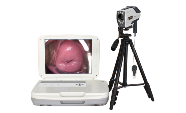 Digital Colposcopy