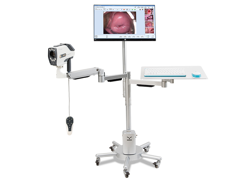 What is a digital electronic colposcope?