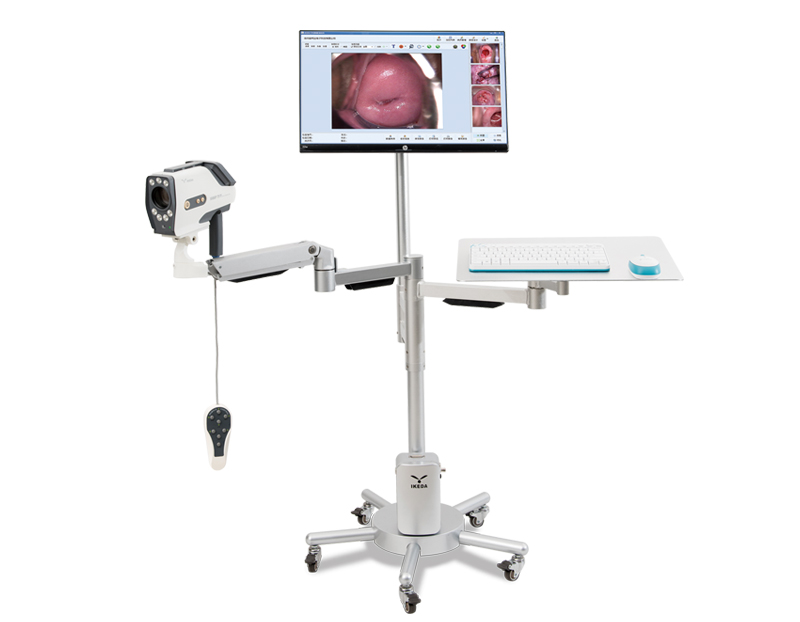 Sony Sensor Digital Colposcope For Gynecology