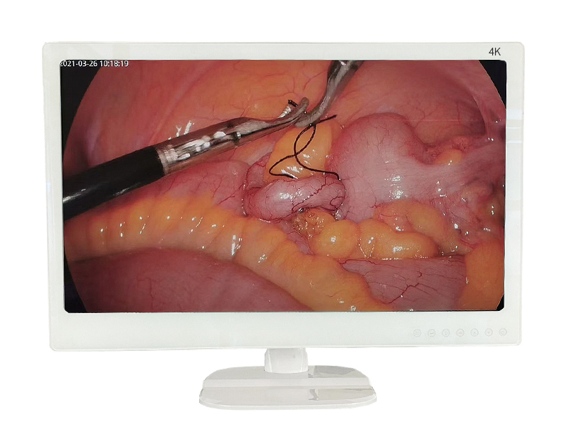 endoscope monitor