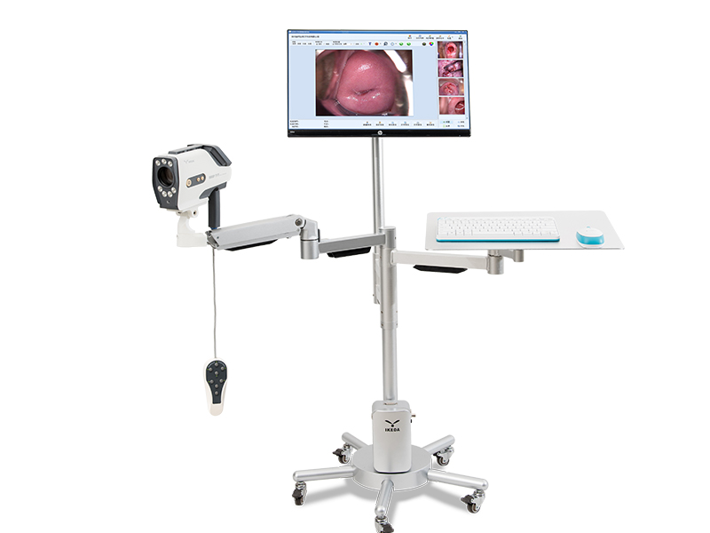 electronic colposcopy