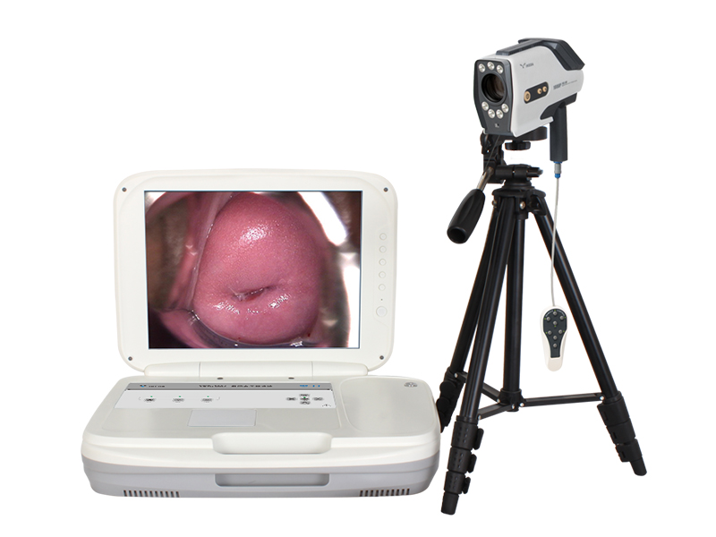 Electronic colposcopy