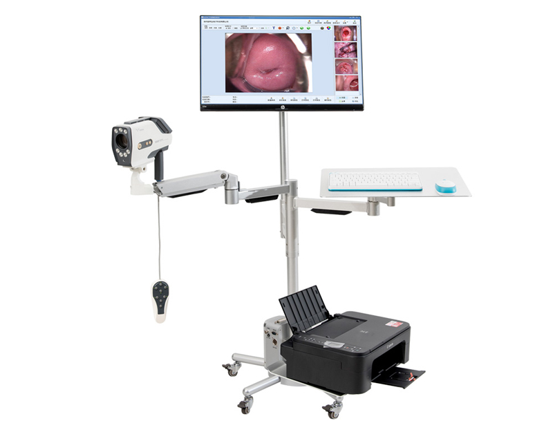 Digital Colposcope