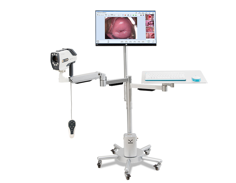 digital colposcope