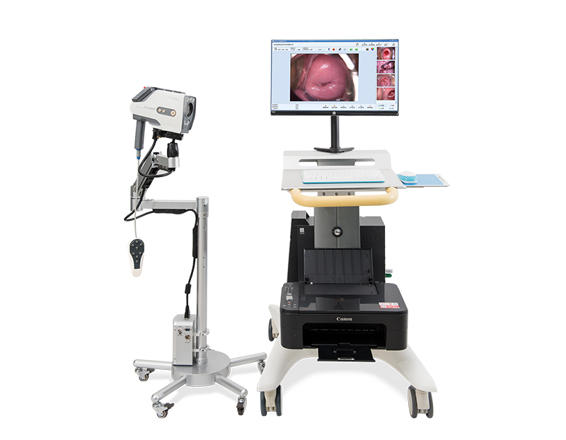 How much is a colposcopy machine?