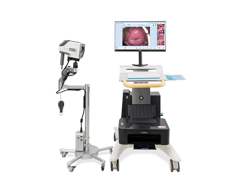 digital video colposcopy