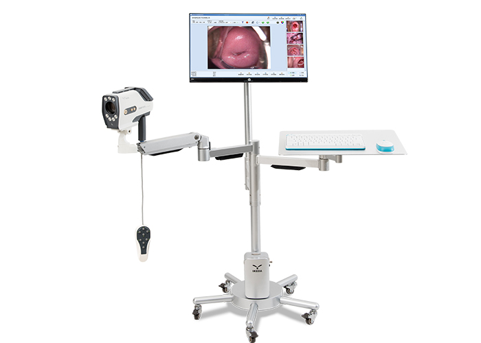 digital colposcope