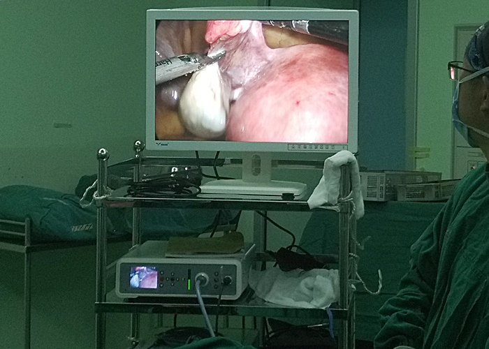 【Gynecological Laparoscopy】Laparoscopic cholecystectomy