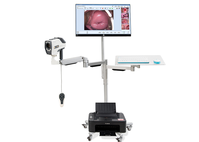 Digital Video Colposcopy