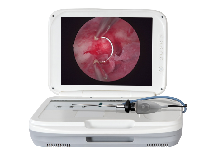 Clinical Application Of Hysteroscope