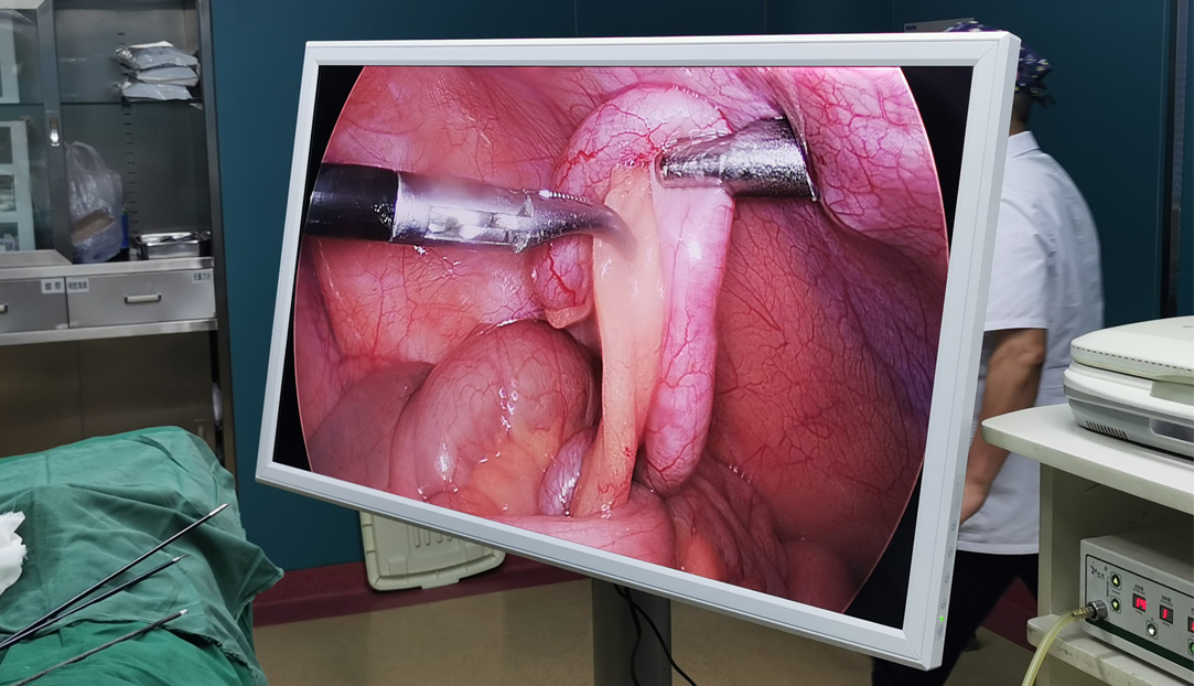 55 inch 4K Medical Monitor Designed By YIKEDA