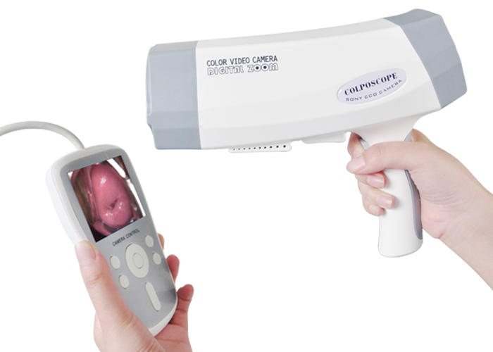 Digital Colposcope Camera