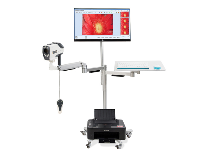 Operation Steps Of Digital Colposcope