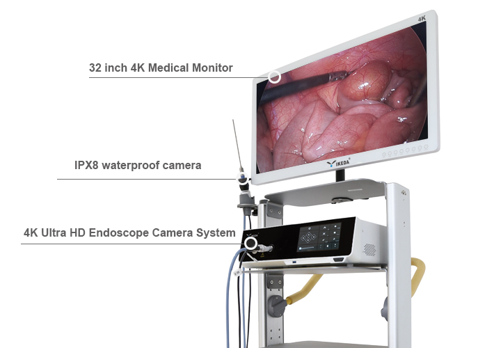 4K Ultra HD Endoscope Camera System