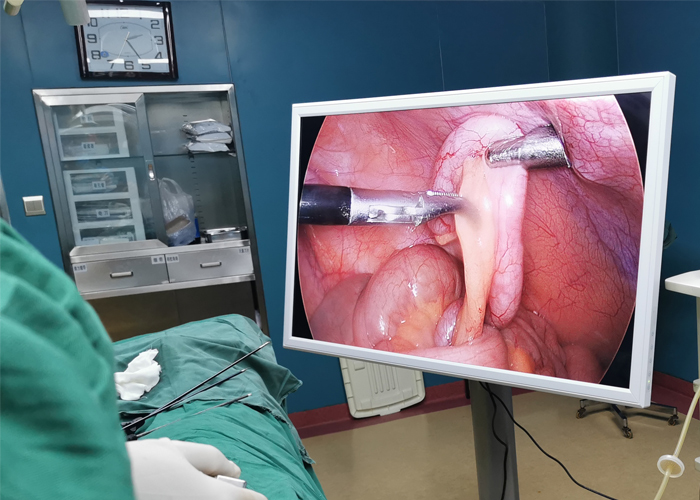 YIKEDA Gynecological Laparoscopy System