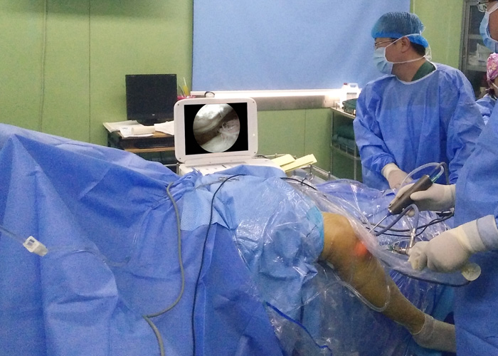 Arthroscopy Lysis For The Treatment Of Knee Joint Adhesions