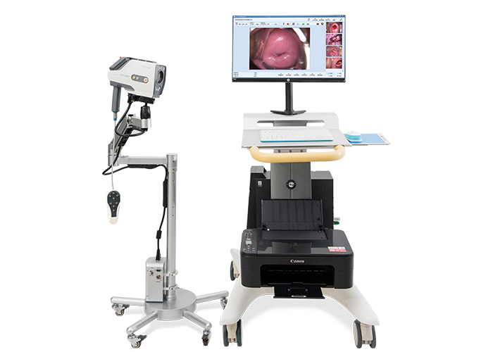 Digital Colposcope