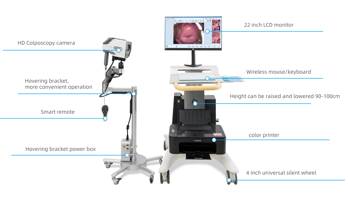 Colposcopy