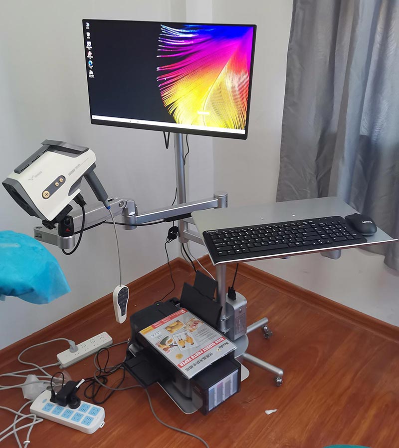 YIKEDA Digital Colposcope Installation Machine