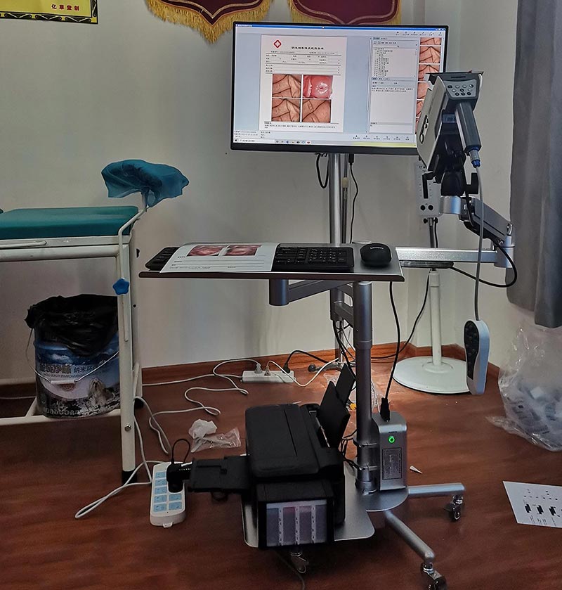 YIKEDA Digital Colposcope Installation Machine