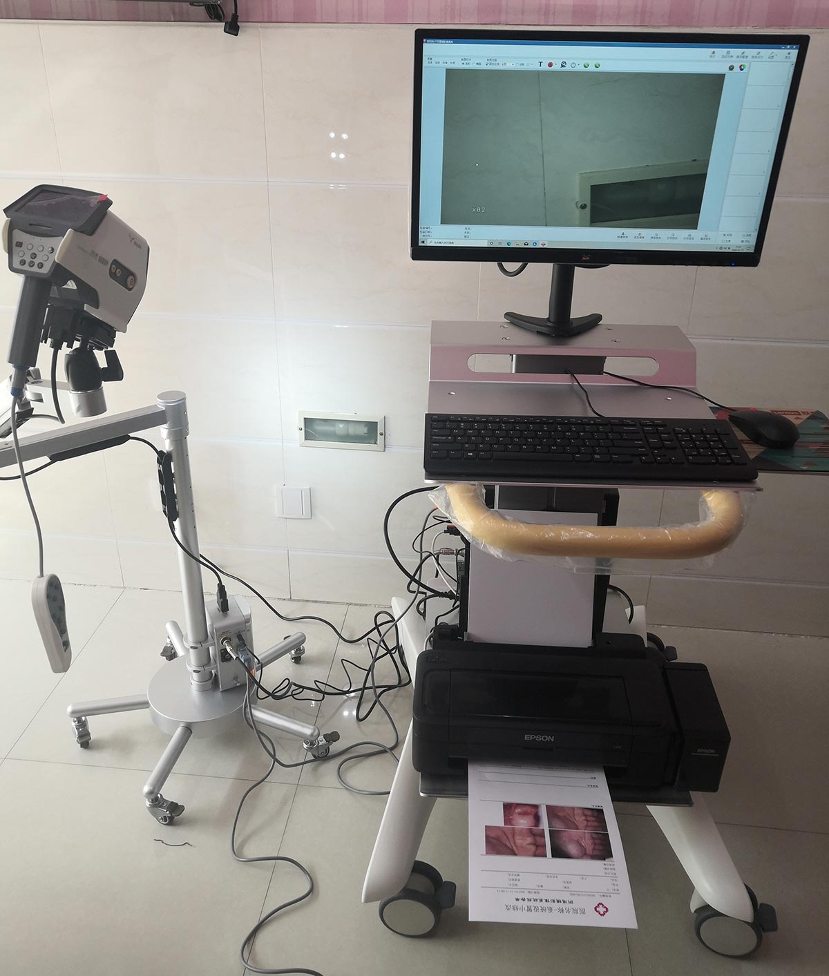 YIKEDA Digital Electronic Colposcopy Hospital Installation