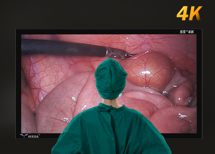 YIKEDA 55 Inch 4K Medical Monitor