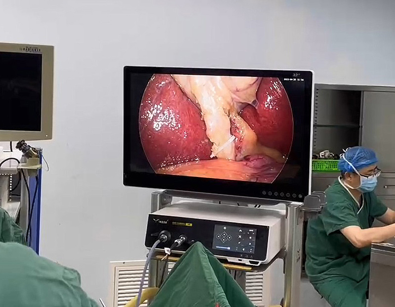 Medical Endoscope Camera System