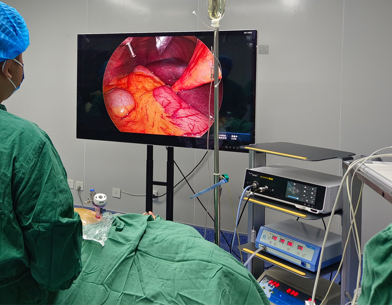 endoscopic camera system