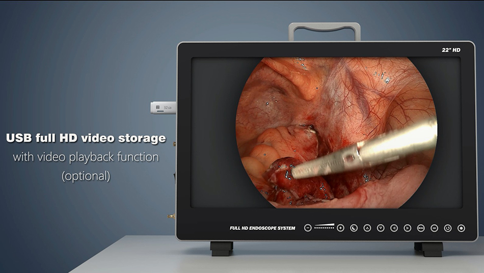 endoscopic camera