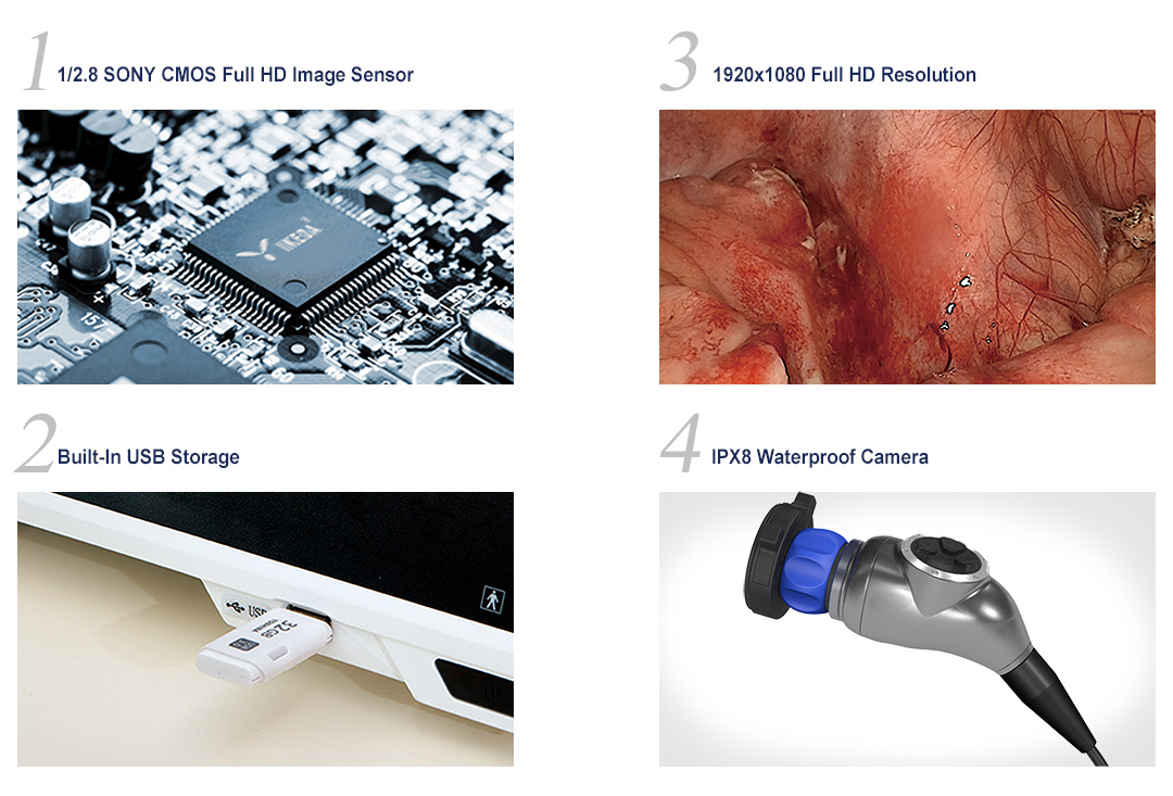 YKD-9103E-T Medical HD ENT Endoscopy Camera