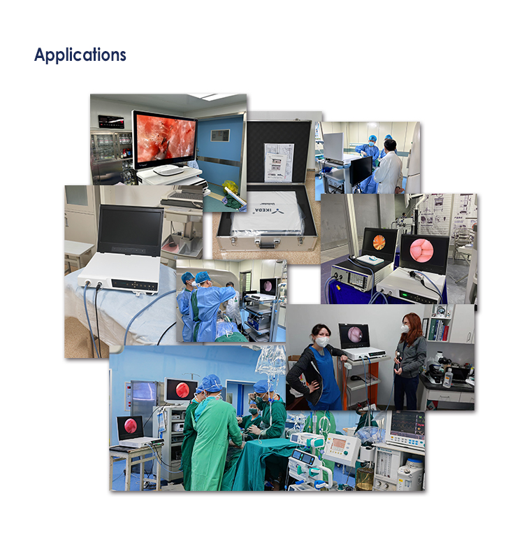 YKD-9101-H  Full HD Endoscopy Camera System