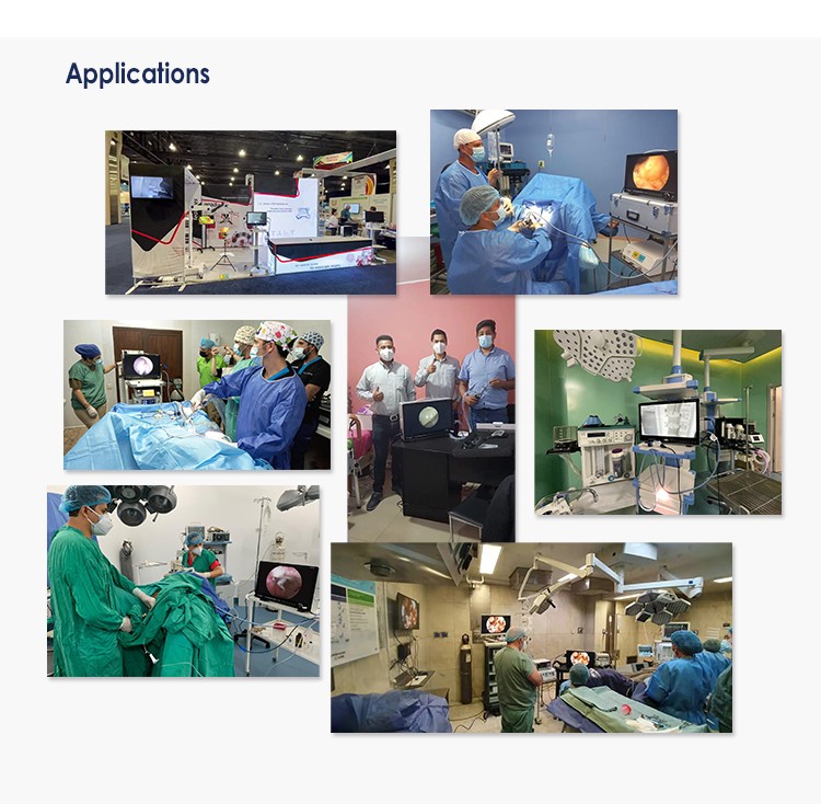 All-in-one Endoscope Camera System