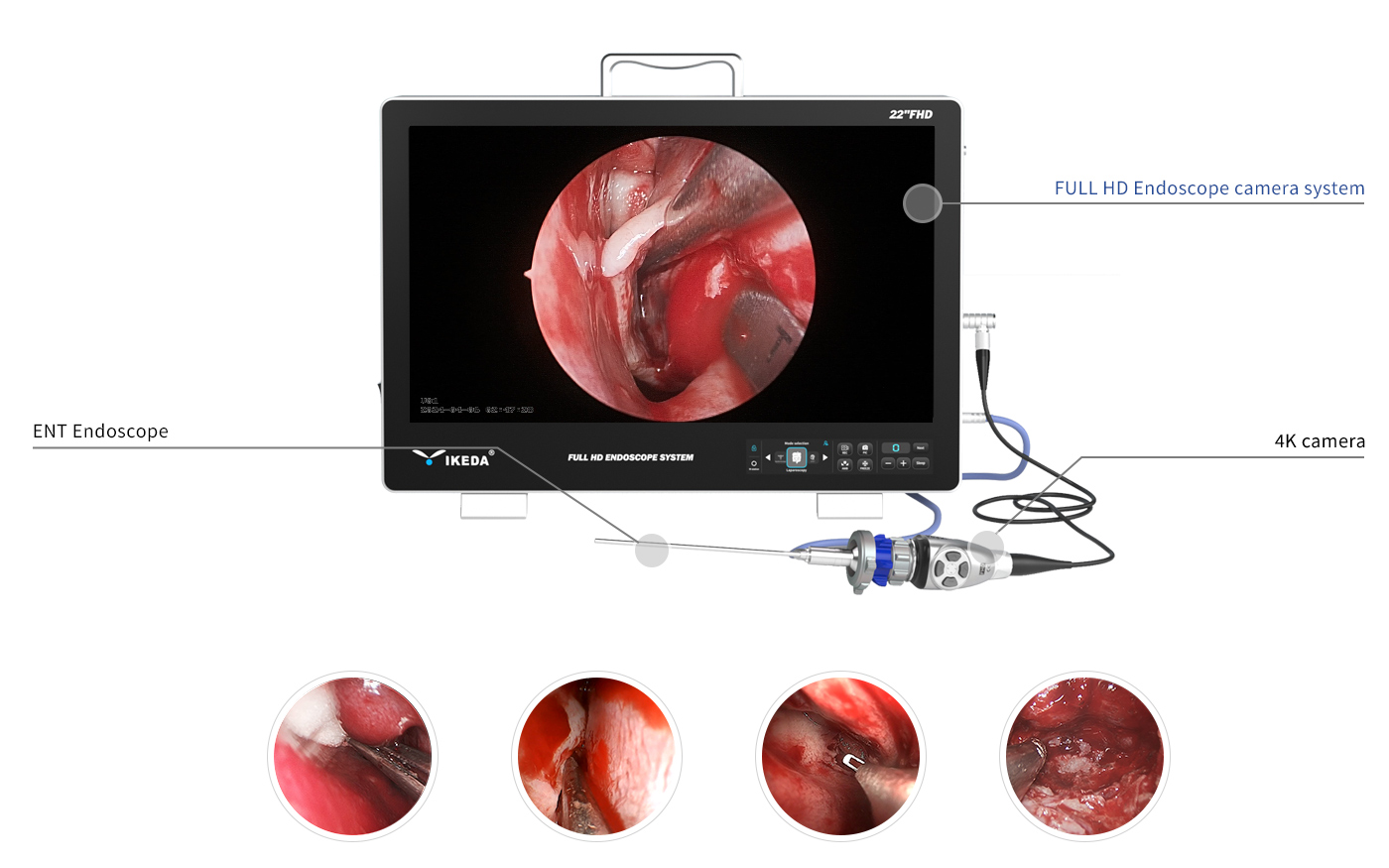 ENT Endoscope Solutions ENT Endoscope Solutions