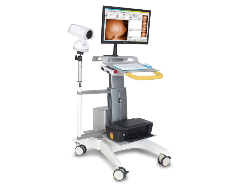 YKD-1001 Full HD Infrared Mammary Gland Examination System