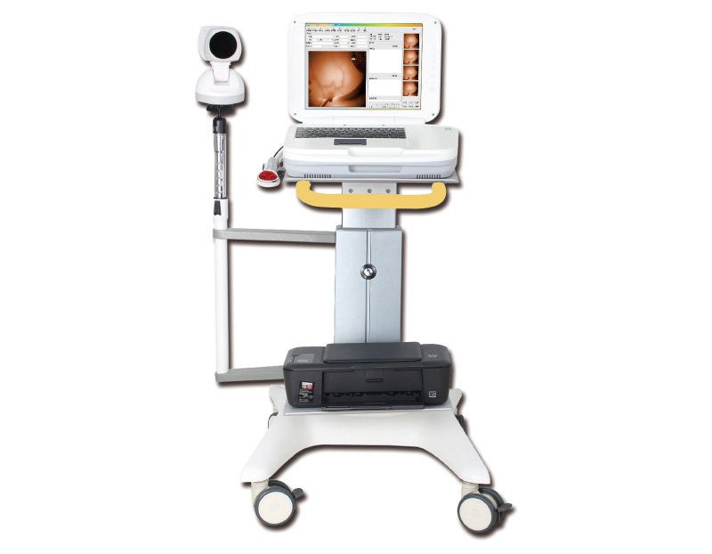 YKD-1003 Medical Infrared Breast Examination System