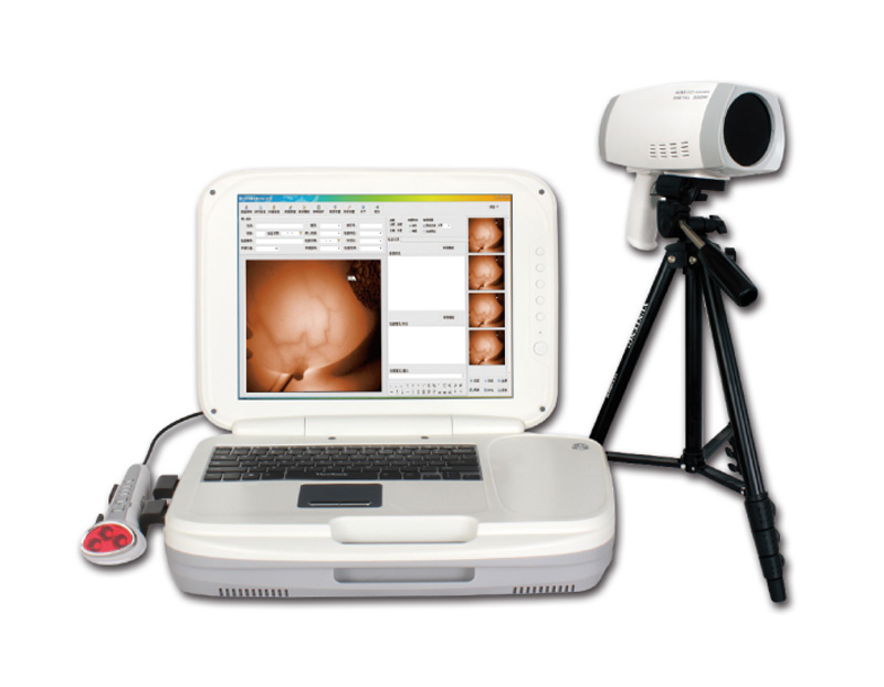 YKD-1004 Portable Infrared Breast Examination Equipment