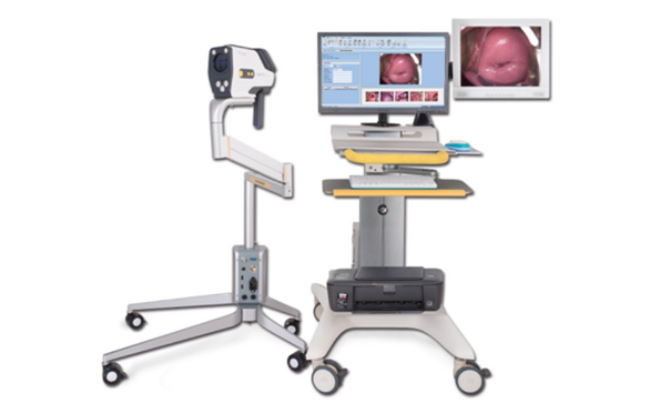 Overview of HD Digital Electronic Colposcope