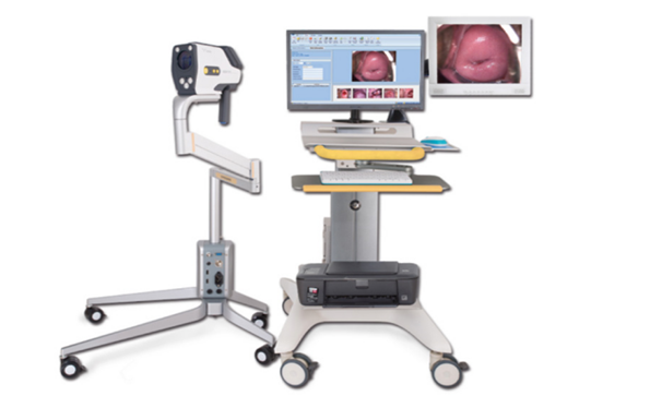 Principle of HD Digital Electronic Colposcope