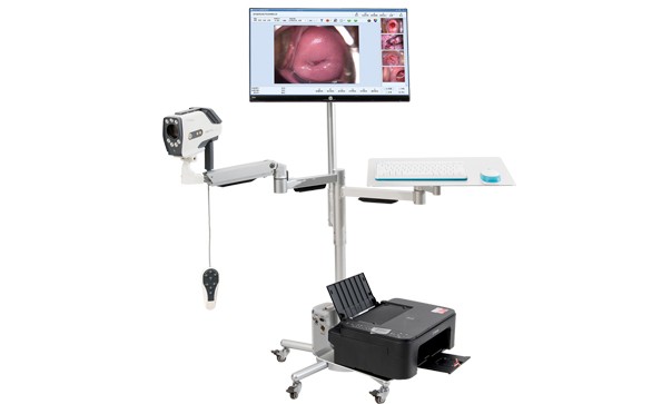 What are the functions of electronic colposcopy?