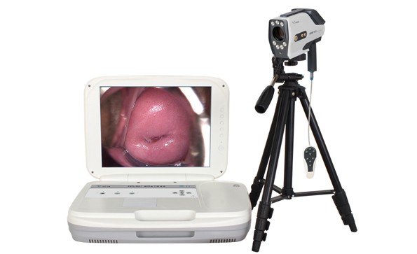 Basic functions of digital electronic colposcope