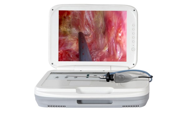 Endoscope manufacturers share with you endoscopic-assisted plastic surgery