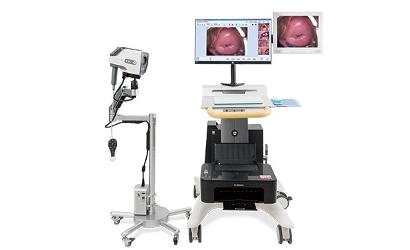 Introduction of electronic colposcopy manufacturers: What problems are prone to occur during the use of electronic colposcopy